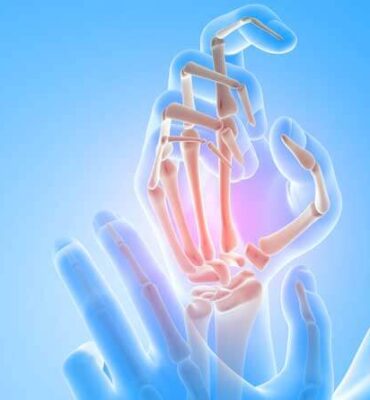 10--treatment-Arthritis-And-Joints-Pain