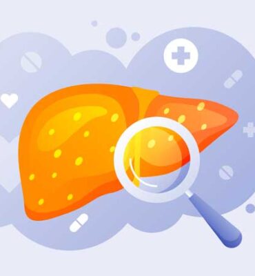 6-Cholesterol-And-Liver-Problems